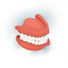 Dental Implant vs Denture