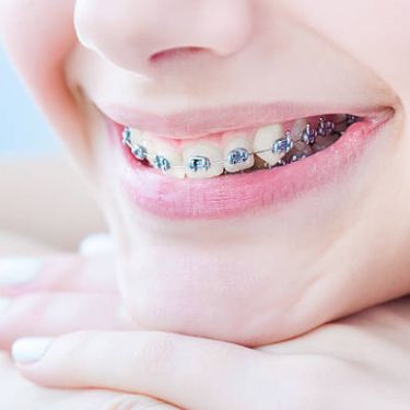dental term Baroda Dental Clinic