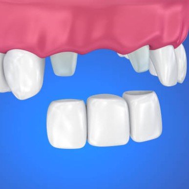 smile makeover Baroda Dental Clinic