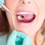 Root Canal Treatments Information