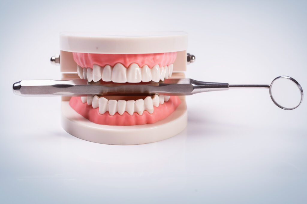 Common FAQs About Denture Repair Services